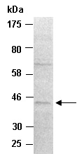 CBX6 Antibody Western (Abiocode)