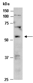 STEAP3 Antibody Western (Abiocode)