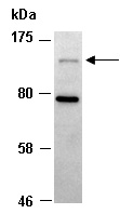 HDAC4 Antibody Western (Abiocode)