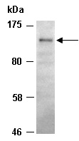 HDAC4 Antibody Western (Abiocode)