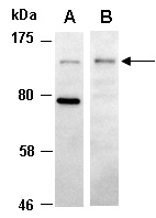 HDAC4 Antibody Western (Abiocode)