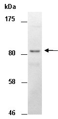 RPS6KA3 Antibody Western (Abiocode)