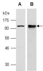 SATB1 Antibody Western (Abiocode)