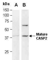 CASP2 Antibody Western (Abiocode)