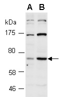 HELIOS Antibody Western (Abiocode)