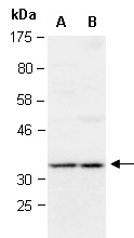 RPL5 Antibody Western (Abiocode)