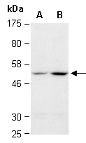 &alpha;-Tubulin Antibody Western (Abiocode)
