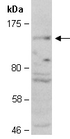 HDAC9 Antibody Western (Abiocode)
