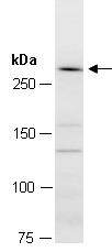 HECTD1 Antibody Western (Abiocode)