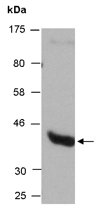 HDAC8 Antibody Western (Abiocode)
