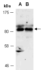 STAT6 Antibody Western (Abiocode)