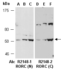 RORC Antibody Western (Abiocode)