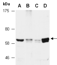 TAB1 Antibody Western (Abiocode)