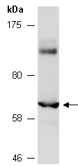 RXRB Antibody Western (Abiocode)