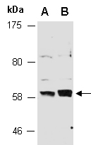 STK4 Antibody Western (Abiocde)