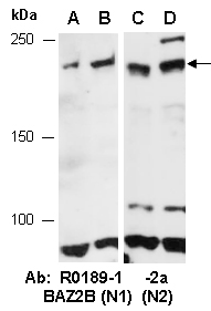 BAZ2B Antibody Western (Abiocode)