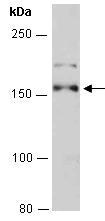 MAP3K1 Antibody Western (Abiocode)