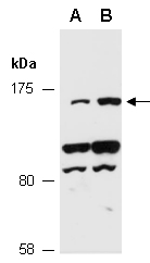 HDAC6 Antibody Western (Abiocode)
