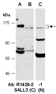 SALL3 Antibody Western (Abiocode)