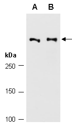 BRCA2 Antibody Western (Abiocode)