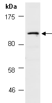 RECQL5 Antibody Western (Abiocode)
