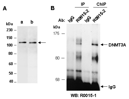 DNMT3A Western IP ChIP Antibody (Abiocode)