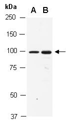 ATXN7 Antibody Western (Abiocode)