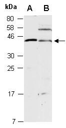 PRKAB1 Antibody Western (Abiocode)