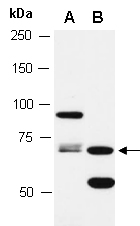 BIRC2 Antibody Western (Abiocode)