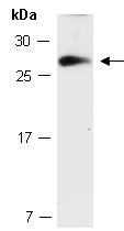 TIMP3 Antibody Western (Abiocode)