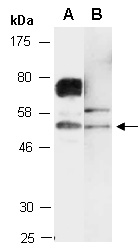 SIRT3 Antibody Western (Abiocode)