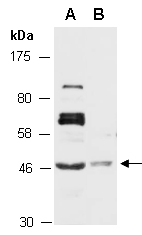 SIRT6 Antibody Western (Abiocode)