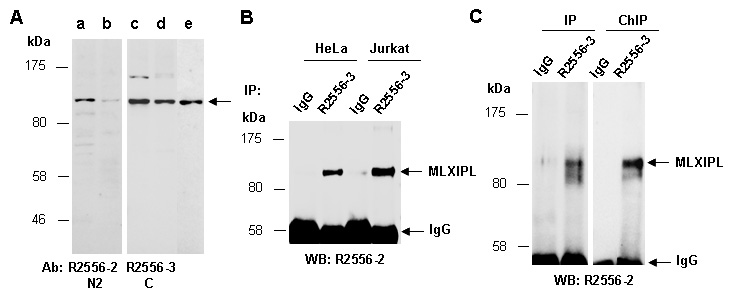 MLXIPL Western IP ChIP Antibody (Abiocode)