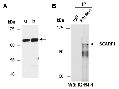 SCARF1 Western IP Antibody (Abiocode)