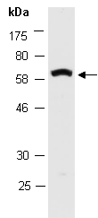 TDT Antibody Western (Abiocode)
