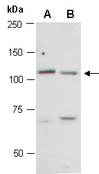 PIK3CA Antibody Western (Abiocode)
