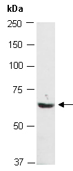 PKM2 Antibody Western (Abiocode)