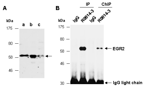 EGR2 Western IP ChIP Antibody (Abiocode)