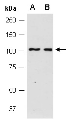 HECTD2 Antibody Western (Abiocode)
