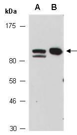 SATB2 Antibody Western (Abiocode)