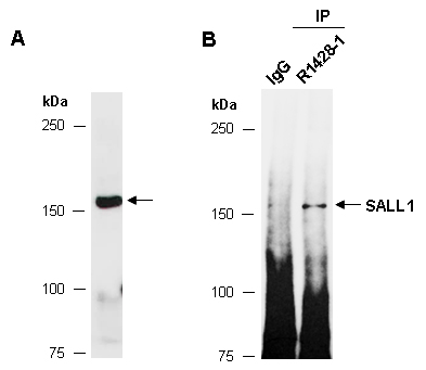 SALL1 Antibody Western (Abiocode)