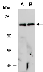 SALL2 Antibody Western (Abiocode)