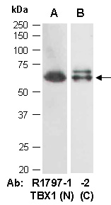 TBX1 Antibody Western (Abiocode)