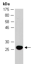 His-Tag Antibody Western (Abiocode)