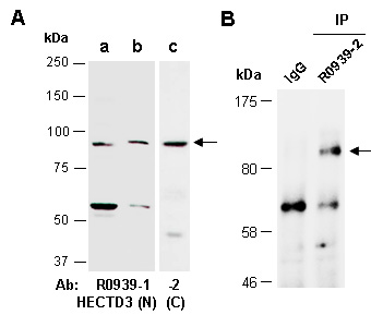 HECTD3 Western Antibody (Abiocode)