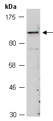 FAM123B Antibody Western (Abiocode)