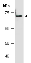 RTEL1 Antibody Western (Abiocode)