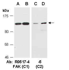 FAK Antibody Western (Abiocode)