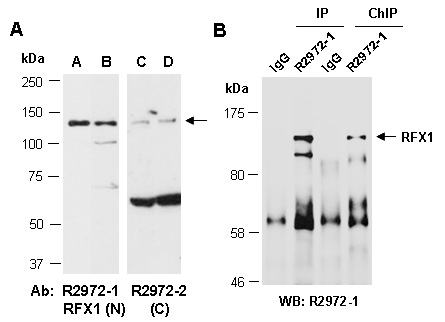 RFX1 Western IP ChIP Antibody (Abiocode)