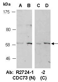 CDC73 Antibody Western (Abiocode)